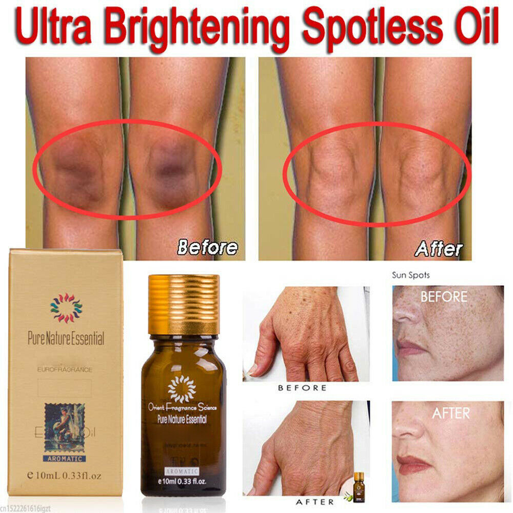 Dark Skin Whitening Lightening Ultra Brightening Serum Dark Spot Bleach Cream Us